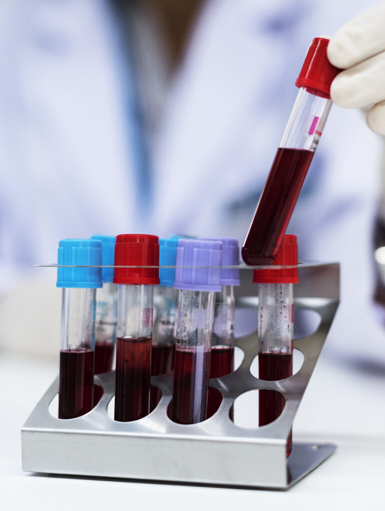 Doctor checking blood samples